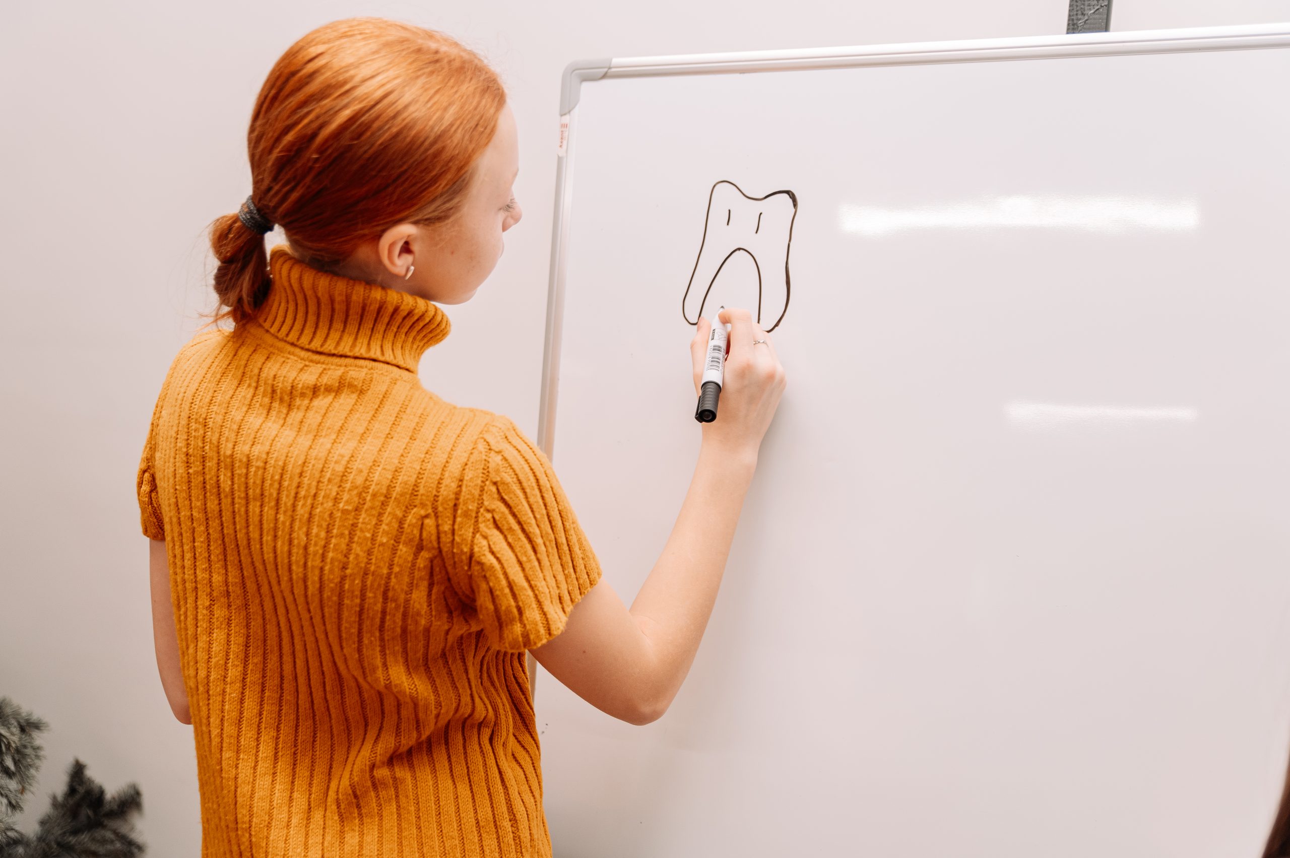 Герметизація фісур 